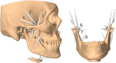 A Dynamic Jaw Model With a Finite-Element Temporomandibular Joint